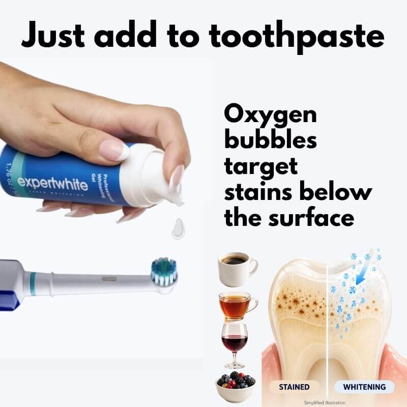 Rediscover a Brighter, Whiter, Younger-Looking Smile