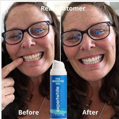 Rediscover a Brighter, Whiter, Younger-Looking Smile
