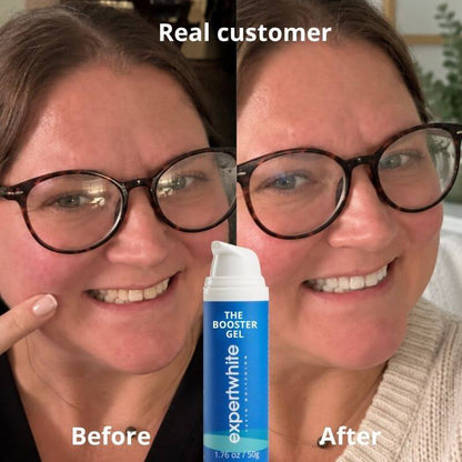 Rediscover a Brighter, Whiter, Younger-Looking Smile