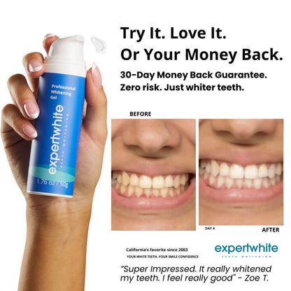 Rediscover a Brighter, Whiter, Younger-Looking Smile